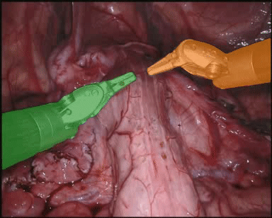 endovis17_3.gif